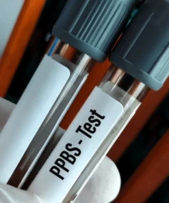 GLUCOSE POST-PRANDIAL, PLASMA