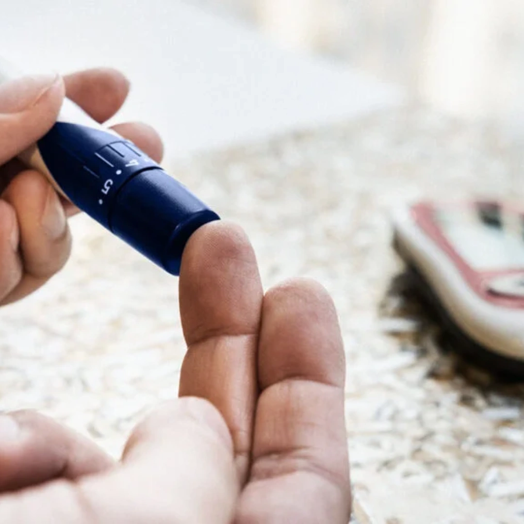 GLUCOSE RANDOM, PLASMA