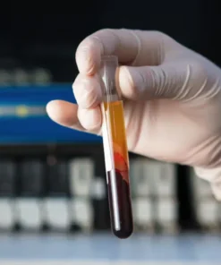 Prothrombin Time, Plasma Citrate