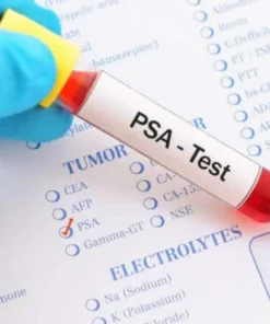 Psa (Prostate Specific Antigen) Total, Serum