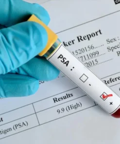 Psa Free(Prostate Specific Antigen), Serum