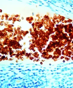 GLYCOPHORIN A (ERYTHROID)