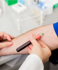 Pseudocholinesterase, Serum