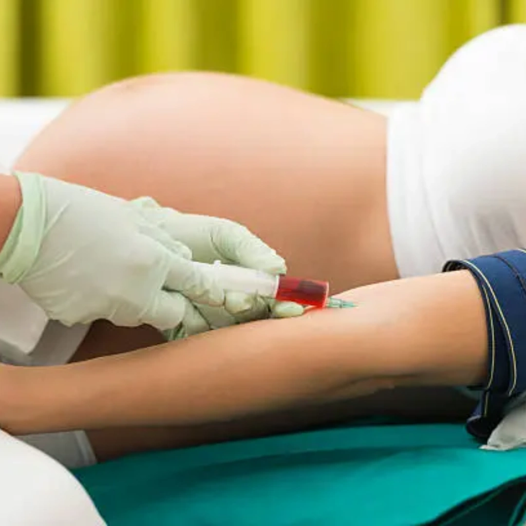 Quadruple Marker Test, Serum