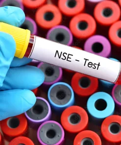 Nse (Neuron Specific Enolase)