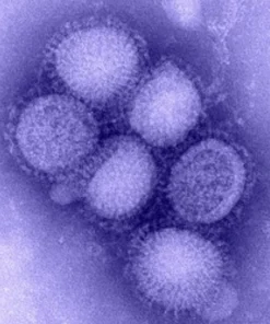 H1N1 (SWINE FLU) REAL TIME PCR