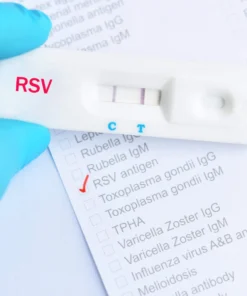 Respiratory Syncytial Virus (Rsv) Igm Antibody