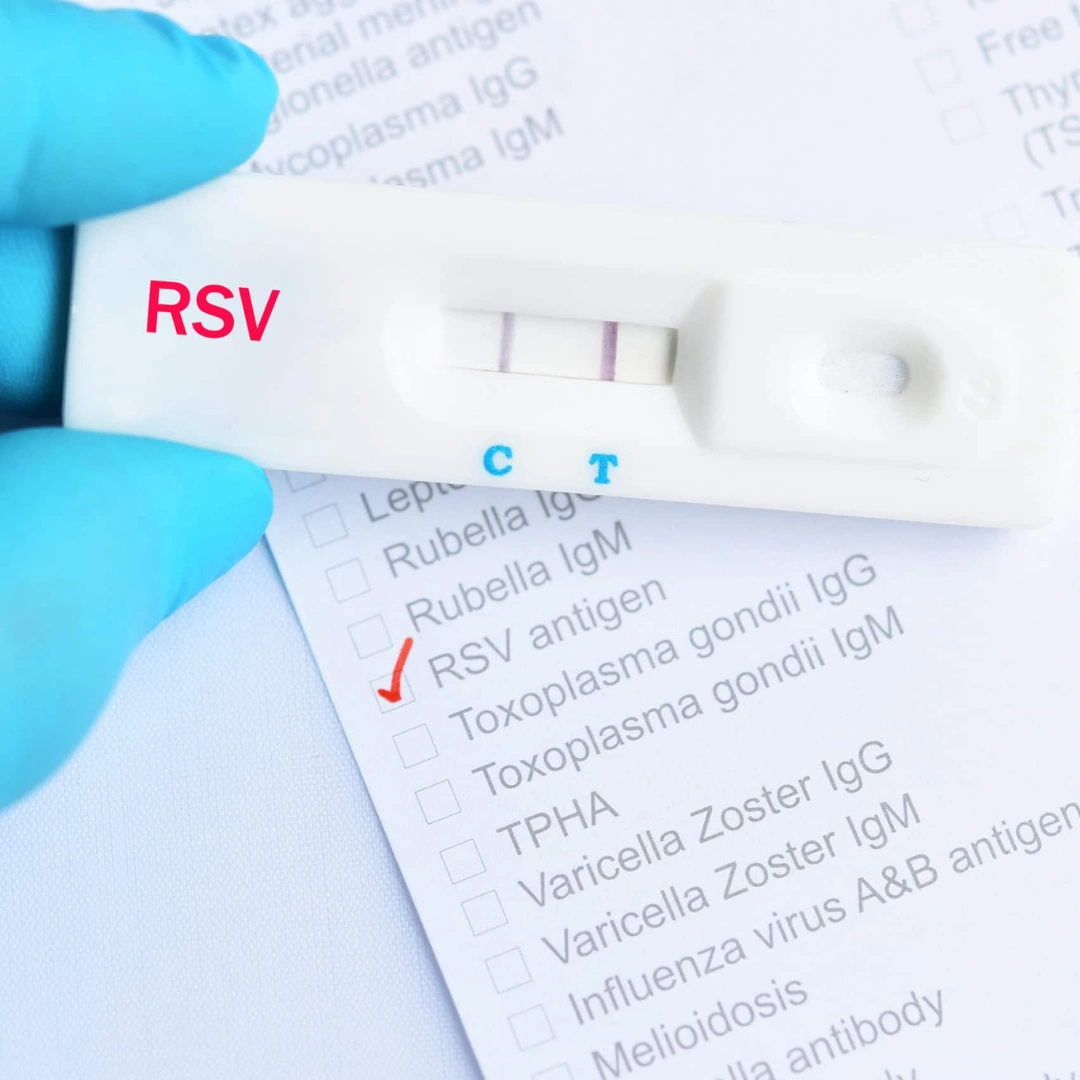 Respiratory Syncytial Virus (Rsv) Igm Antibody