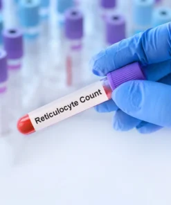 Reticulocyte Count, Whole Blood