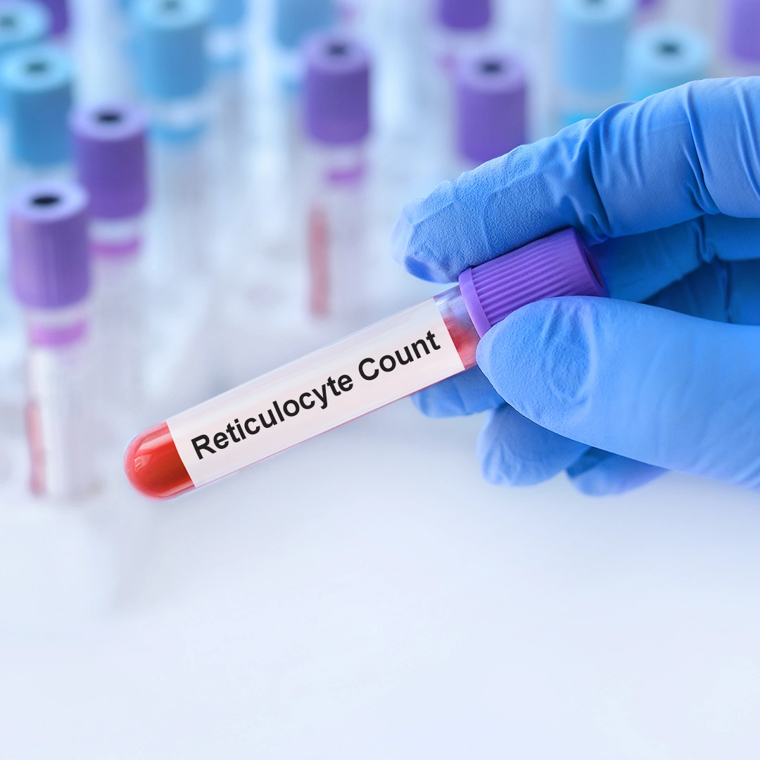 Reticulocyte Count, Whole Blood