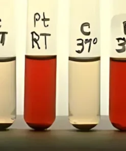 HAM TEST (ACIDIFIED SERUM LYSIS TEST)