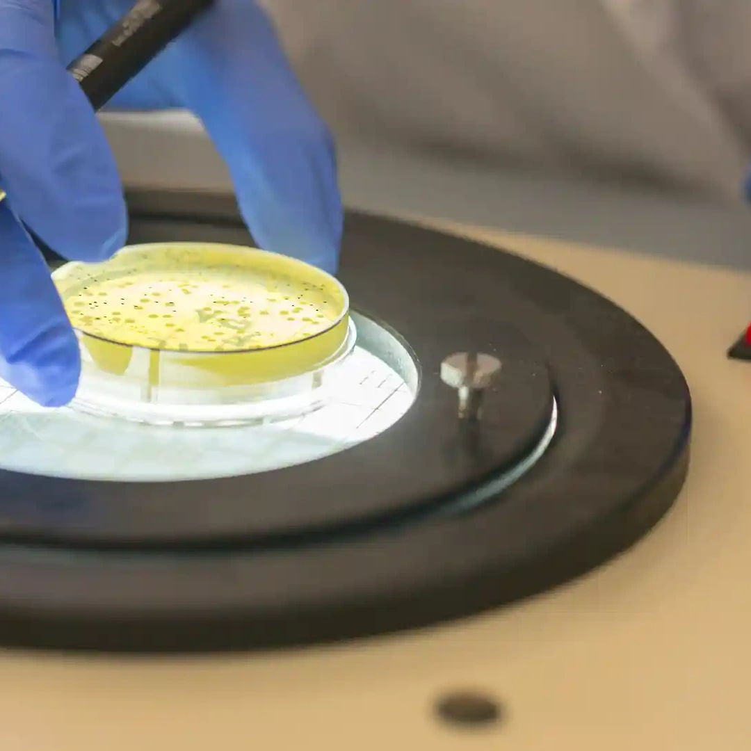 HANGING DROP PREPARATION