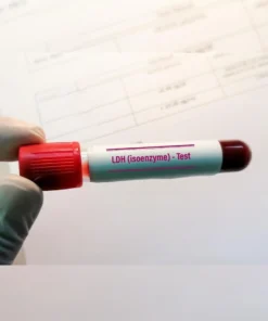 Ldh Isoenzymes Gel Electrophoresis, Serum