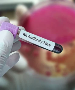 Rh Antibody Titer