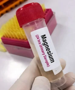 Magnesium, 24 Hrs Urine