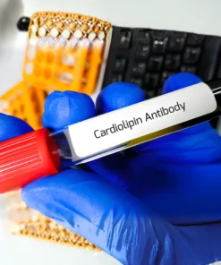 CARDIOLIPIN ANTIBODIES IGG, SERUM